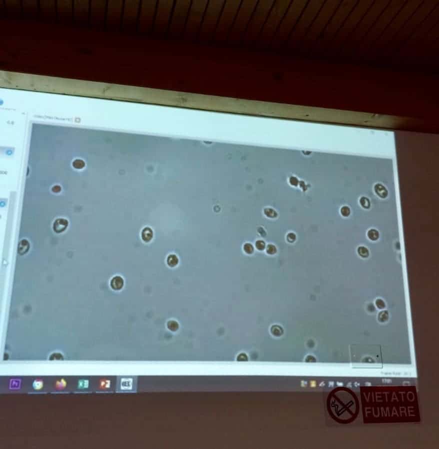 conta dei lieviti a microscopio ottico